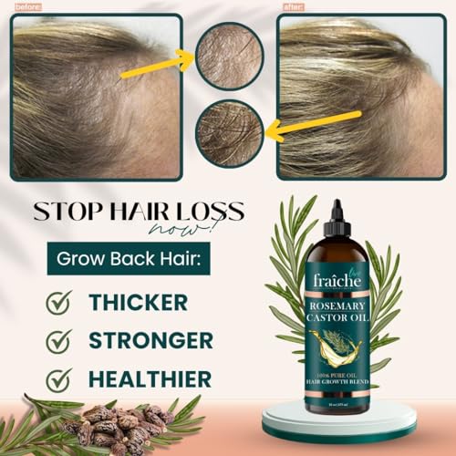 Live Fraiche Rosemary Castor Oil 16oz Pack of 2 for Hair Growth & Thickening