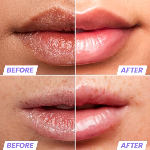 Wonderskin Lip Stain Peel Off Masque (Romance) with Lip Rehab Serum Oil
