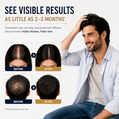 Minoxidil Hair & Beard Growth Serum - 3 Pack Dropper 3pcs - Unisex, 5%, 6 Fl Oz