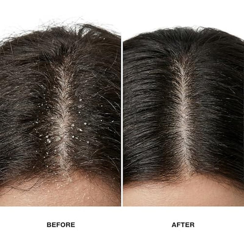 GK HAIR Anti-Dandruff Shampoo Leaving Your Scalp Refreshed and Hair Soft, Smooth ? Sulfate-Free Shampoo for Dry Damaged Hair for Men and Women 8.5 Fl Oz