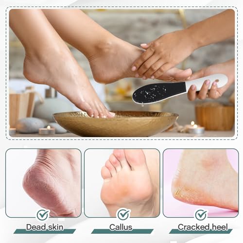 Lothee 30 Pack Double Sided Foot File Callus Remover - Pedicure Tool for Dead Skin & Cracked Heels, White, Variation 30