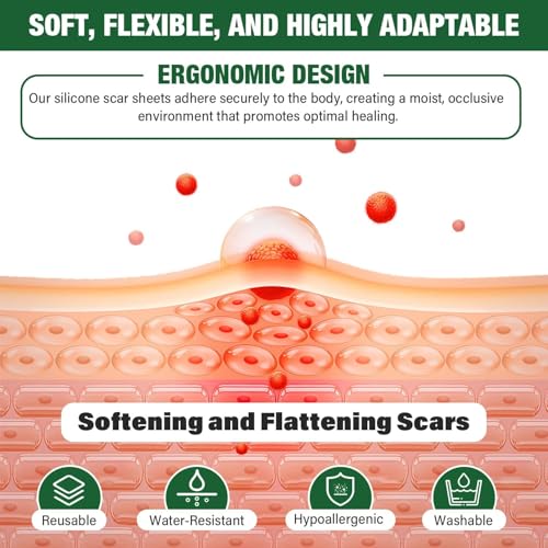 Silicone Scar Sheets,Silicone Scar Tape,Silicone Sheets For Scars,Scar Tape For Surgical Scars,Keloid Bump Removal,Scar Removal For Surgical(1.6"x 60" Roll-1.5M)
