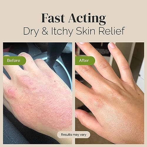 Puriya Tea Tree Oil Balm and Mother of All Creams with Mildly Earthy Scent Bundle Set, Plant Rich Wonder Balm, Moisturizing Cream for Dry, Itchy, and Sensitive Skin