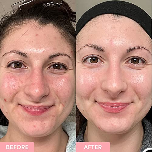 Brightening Toner with Niacinamide & Glycolic Acid - 4.2 fl oz Natural Exfoliating Skin Care