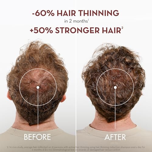 Klorane Strengthening Shampoo with Quinine 13.5 Fl Oz - Hair Thickening & Hair Loss Support - Pack of 1