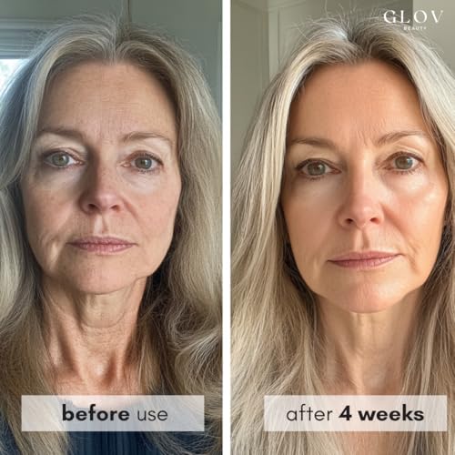 Glov Beauty Face Moisturizer with Squalane & Niacinamide - Anti Aging Hydrating Face Cream for All Skin Types, Daily Moisturizer Face Cream for Women
