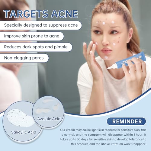 Azelaic Acid 14% Acne Cream for Redness Relief, Dark Spots, Facial Serum with Niacinamide & Vitamin C Prevent Acne Breakouts, Azelaic Acid Serum for Balance Excess Sebum & Soothe Irritation, 1 Oz.