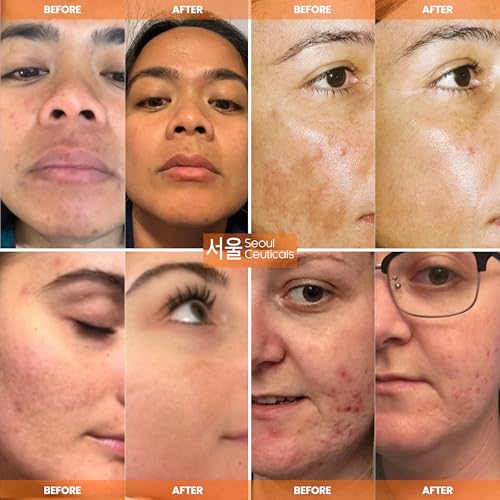 SeoulCeuticals Vitamin C Serum 20% + CE Ferulic for Face 2oz Citrus Pack
