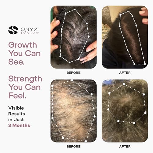 Hair Growth Serum for Women & Men – Oil-Free, Peptide & Biotin Formula