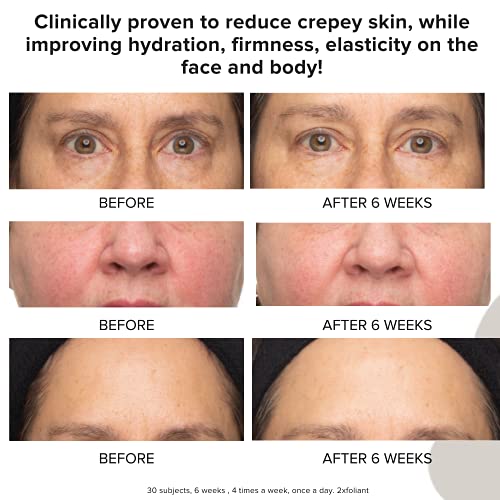 Priori Skincare Peel and Scrub for Face and Body - Lactic Acid Retinol Vitamin C, E At-Home Microdermabrasion Anti-Irritant Dermatologist Tested