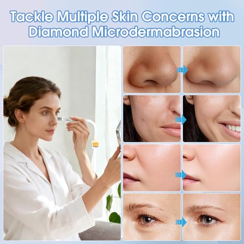 Pro Cordless Microdermabrasion Machine, Beauty Star Portable Facial Pore Vacuum Tool for Blackhead Removal, Glowing Skin, 3 Diamond Tips & 9-Setting Suction, Home and Salon Use