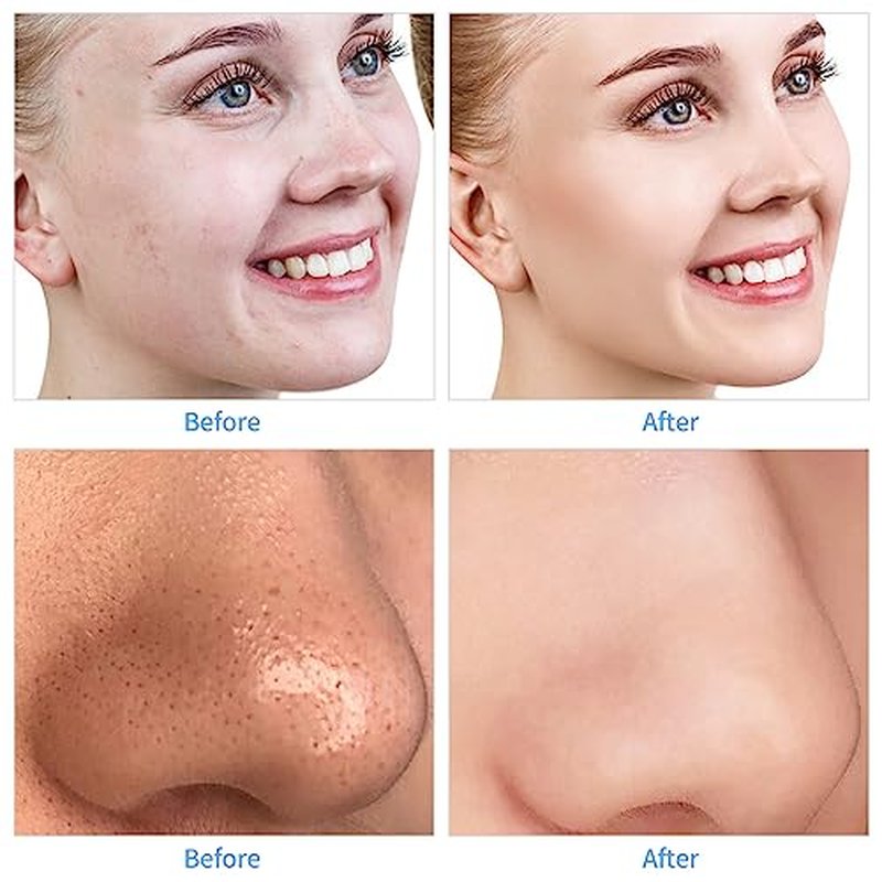 Diamond Professional Microdermabrasion Machine, Portable Dermabrasion Crystal for Facial Skin Care Tool,Face Blackhead Remover Devices Kit,Home Use Microderm Equipment for Women Men