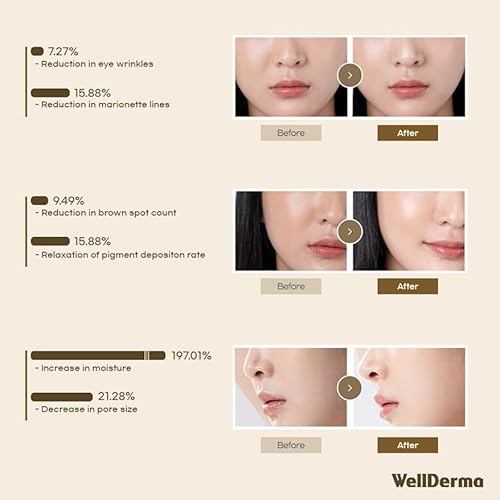 WELLDERMA Sapphire Collagen Impact Hydrogel Fitting Mask, 25g x 16 Sheets ? Hydrating & Firming Micro-Hole Sheet Mask with Collagen Water 850,294ppm, Niacinamide & Peptides