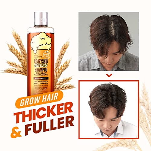 German Beer Yeast Hair Growth Shampoo - 10.15 Fl Oz Pack of 2, Biotin & Natural DHT Blockers, Sulfate-Free, All Hair Types