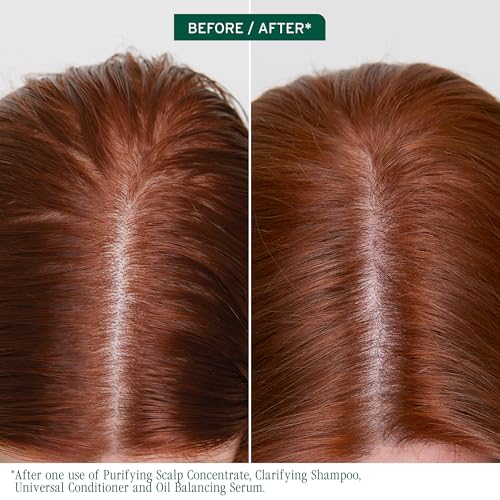 Oil Balancing Serum for Oily Scalp - Scalp Sync by Biolage, 1.6 fl oz