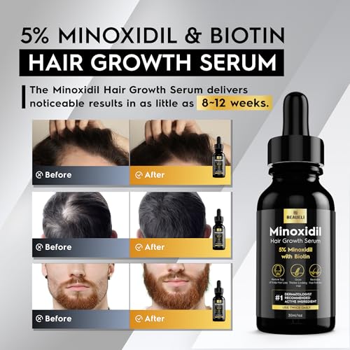 Beaueli 5% Minoxidil Hair & Beard Growth Serum - 1oz Pack of 3 for Men & Women