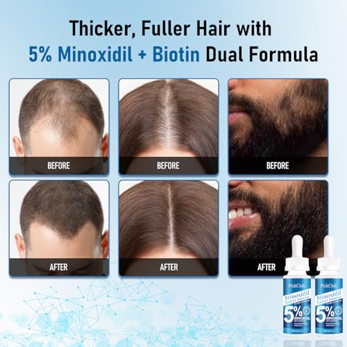Minoxidil Hair and Beard Growth Serum 4-Pack - Fast Absorbing, Unscented, 8.12 fl oz