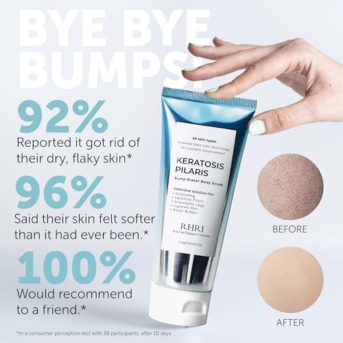 KP Bump Eraser Body Scrub with 10% AHA - Keratosis Pilaris Treatment - KP Scrub