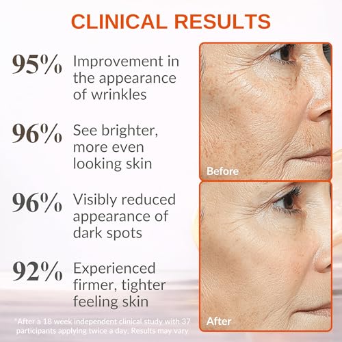 LeVaye Vitamin C Serum for Face Anti-Aging Brightening & Wrinkle Reduction