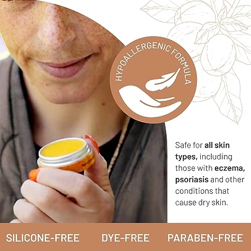 Karit? Nourishing Hand Cream & Lip Balm Travel Collection - Shea Butter, Organic Jojoba & Rosehip Oil Blend - Bliss for Dry Lips & Hands - Intense Hydration, Cruelty-Free, Hypoallergenic Vegan Lip & H