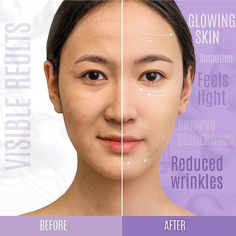 Lift & Firm 30% Peptide Serum for Face ? Anti-Aging Serum with Vitamin C, E, Matrixyl 3000, Aloe Vera & Hyaluronic Acid ? Multi-Peptide Formula to Lift, Firm & Rejuvenate Skin (8 fl oz)