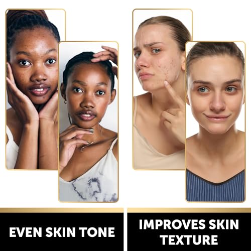 VALITIC Snail Mucin Kojic Acid Soap Bar 4 Pack - Anti-Aging & Skin Brightening