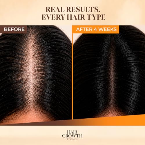 Hair Growth Serum 2 Fl Oz - Thicker Hair & Scalp Revitalizer with Botanical Extracts
