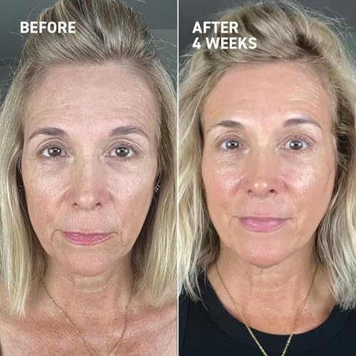 Dermal Micro Needling Serum 1 oz - Collagen Boosting Skin Rejuvenation