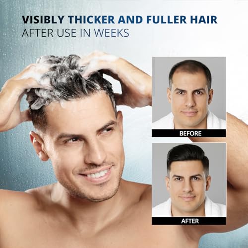 Psalmonica Root Activator Shampoo for Hair Growth - 10.1 Fl Oz Herbal Hair Loss Treatment for Men & Women