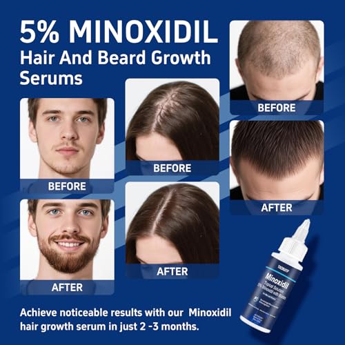 Minoxidil Hair and Beard Growth Treatment - 6 Pack, 5% with Biotin & Castor Oil, Support Thicker Fuller Hair & Beard, 12 fl oz