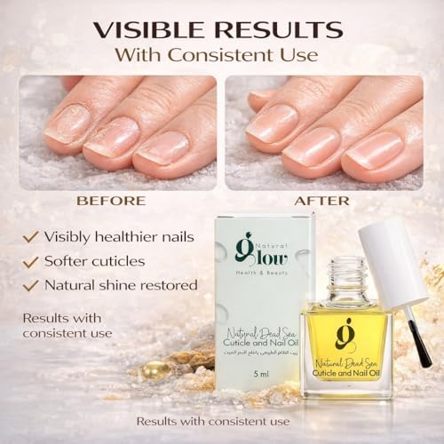 Dead Sea Nail & Cuticle Oil 5ml - Strengthens & Deeply Moisturizes Dry Nails
