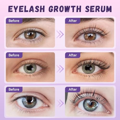 Eyelash Growth Serum with Gentle Formula for Longer, Thicker, Voluminous Lashes - Safe for Sensitive Eyes, Vegan, Natural & Cruelty-Free (5ml)