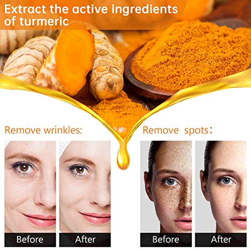 Turmeric Serum for Dark Spots£¬2 PCS Face Serum Turmeric Dark Spot Corrector Serum for Face, Moisturizing Massage Essence Reduces Hyper pigmentation Age&Sun Spot, Facial Serum for Women & Men 1Fl Oz