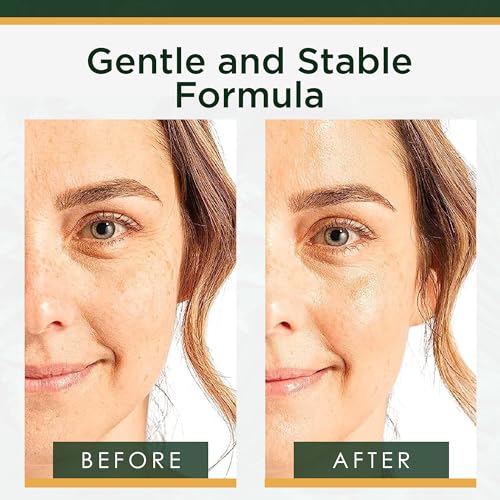 Rejuvenation Collection - Vitamin C & Retinol Skin Care Set - 3 Pieces