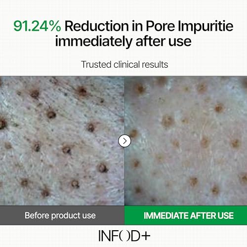 Gentle Low pH Facial Gel Cleanser for Sensitive Skin & Pore Care