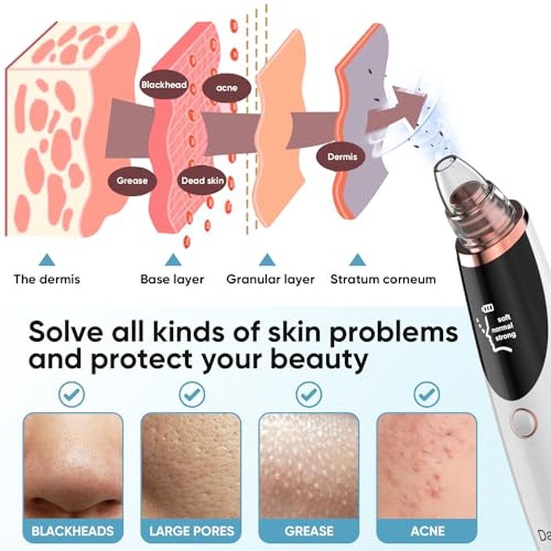 Blackhead Remover Pore Vacuum for Face & Nose ? Deep Cleansing Blackhead Remover Tools with 3 Suction Levels, 5 Replaceable Tips, USB Rechargeable Pore Cleaner