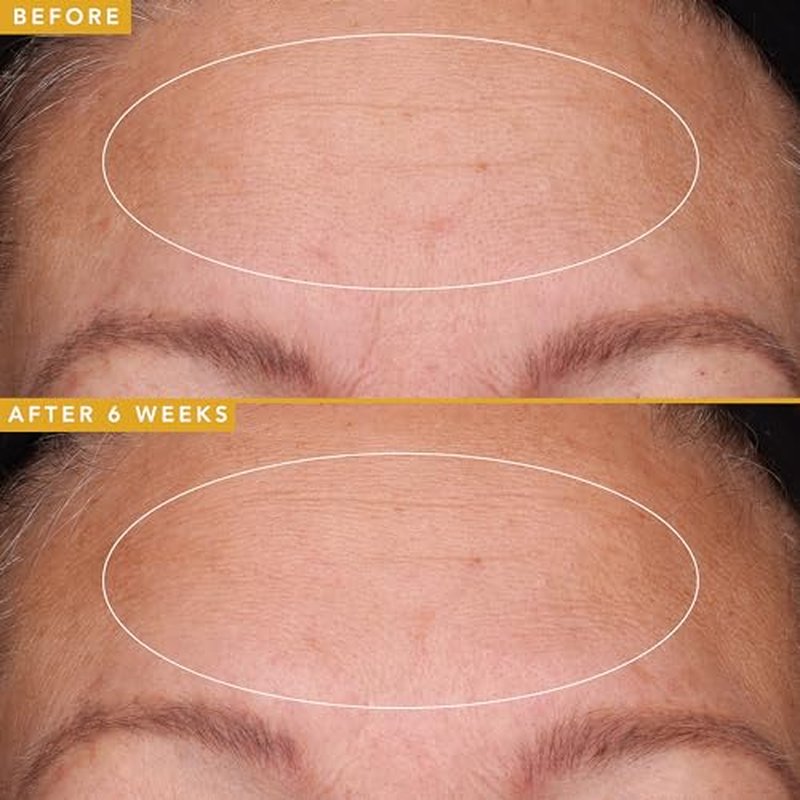 Farmacy Hyaluronic Acid Serum for Face - Filling Good Face Serum with Vegan Collagen Peptides - Helps Smooth Fine Lines + Wrinkles - Hydrating, Plumping + Anti Aging Skin Care (5ml)
