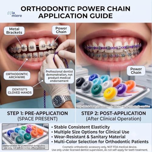 LA MIERE Orthodontic Power Chains 15'' Mix Colors, Closed 0.113’’, Durable Rubber Braces Loops