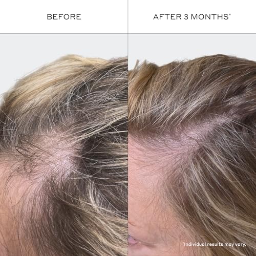 Zenagen Revolve Women's Travel Hair Care Duo for Thinning Hair 2.5 Fl Oz