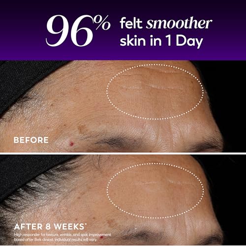 1 Fl Oz Olay Regenerist Resurfacing Retinol Serum - Anti-Wrinkle & Anti-Aging Night Treatment