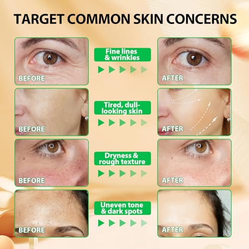 Vitamin E Oil for Skin,75,000 IU Pure Vitamin E Oil for Face, Hair,Nail & Body Tightening Plump Skin,Reduce Fine Lines & Scars,Moisturizing & Smooth,Non-GMO