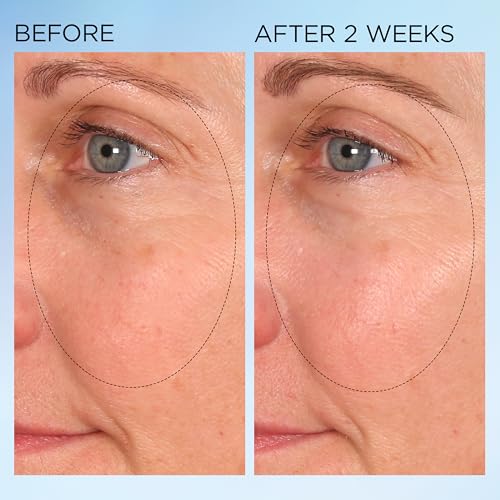 Elizabeth Arden Visible Brightening Clearly Radiant Dark Spot Corrector & Vitamin C Serum Capsules, Corrects Post-Acne Scars, Reduces Pores & Evens Skin Tone