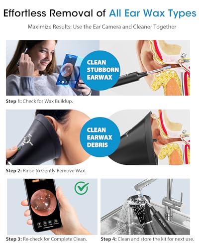 KAUGIC Ear Cleaner with Camera & Irrigation - Black, Overheat Protection