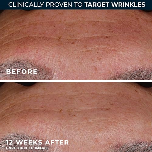Deep Wrinkle Serum with Retinol and Vitamin C - Anti-Aging Face Treatment