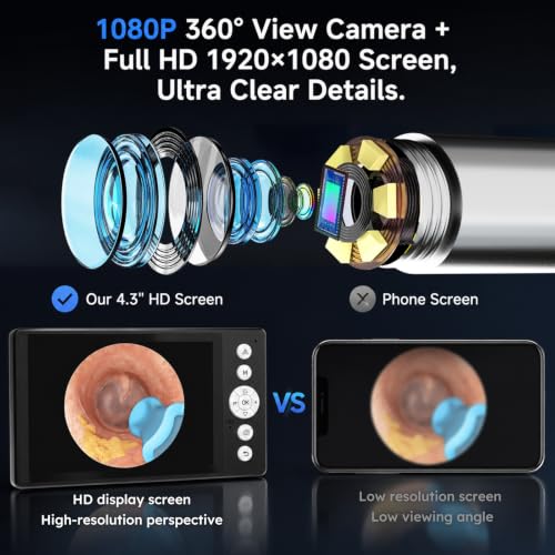 Wireless Ear Otoscope with 4.3-Inch HD Screen and Ear Wax Removal Kit