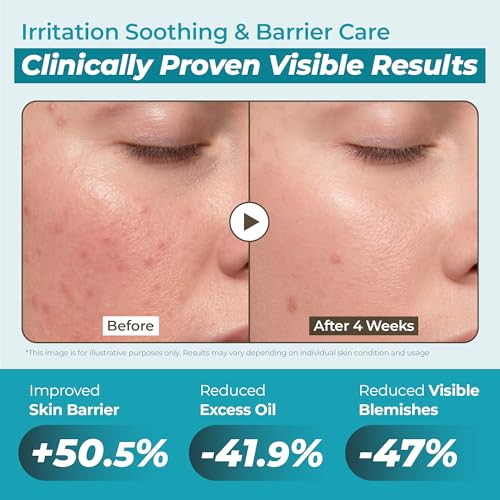 Snail Mucin 88% + Peptide Gel Moisturizer - Non-Sticky, Fast Absorbing