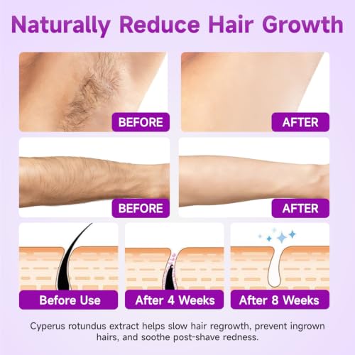 Cyperus Rotundus Oil Serum for Hair Removal & Regrowth Inhibition - 2 Fl Oz