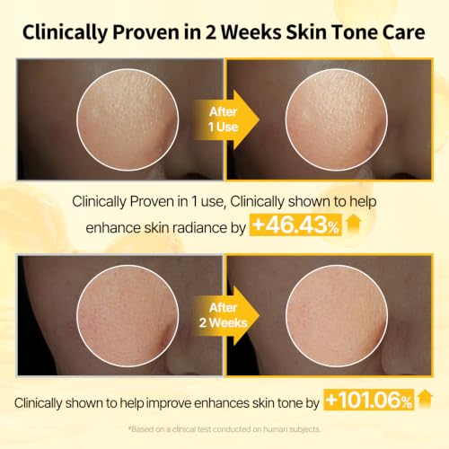 Vitamin C Serum Brightening & Hydrating Skin Care for Dark Spots - 0.4 fl oz