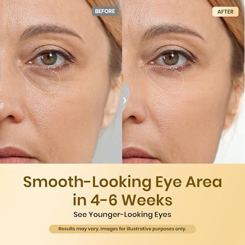 Beetles Caffeine Eye Cream with Retinol, Blur & Glow Under Eye Cream for Dark Circles & Puffiness, Help Improve the Look of Fine Lines, Brighten Eyes Care with Cooling Metal Tip, 0.68 fl oz (20 ml)