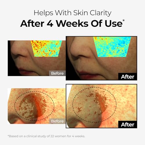 Dark Spot Correcting Duo with TXA & Niacinamide - Skin Turnover & Brightening Serum